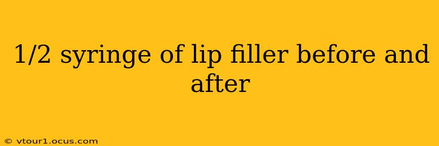 1/2 syringe of lip filler before and after