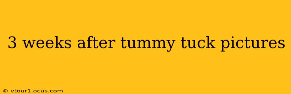 3 weeks after tummy tuck pictures