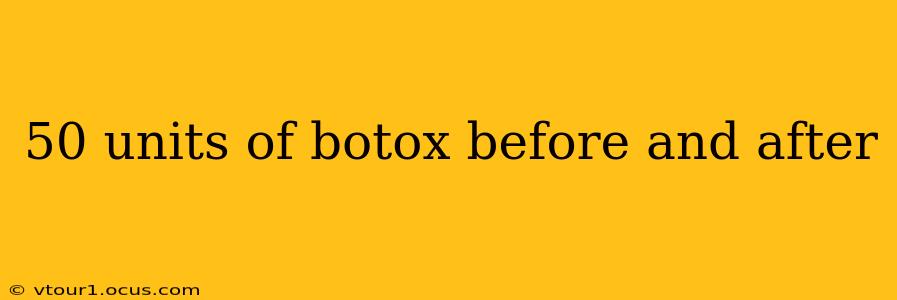 50 units of botox before and after