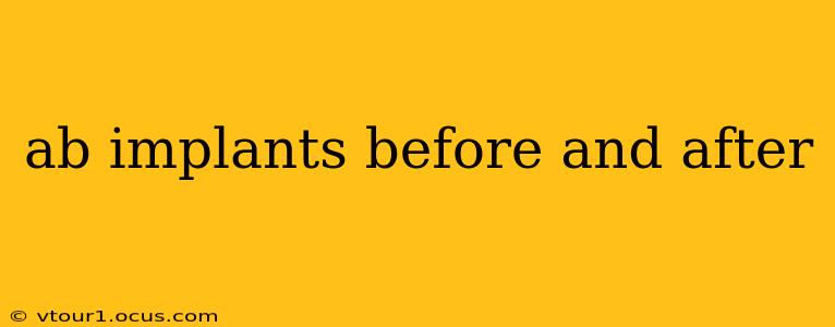 ab implants before and after