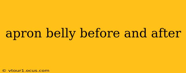 apron belly before and after