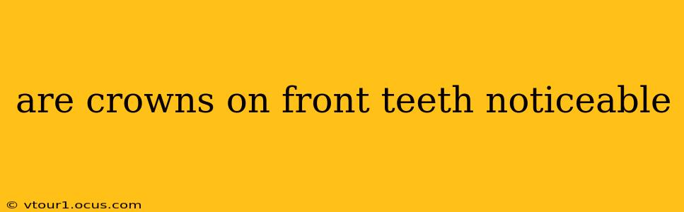 are crowns on front teeth noticeable