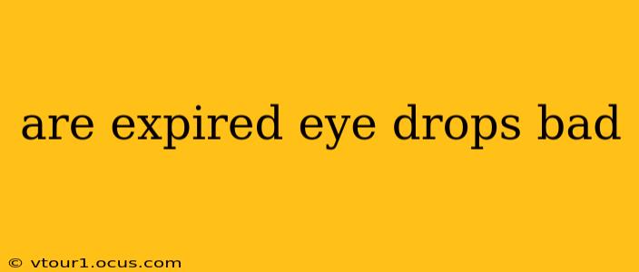 are expired eye drops bad