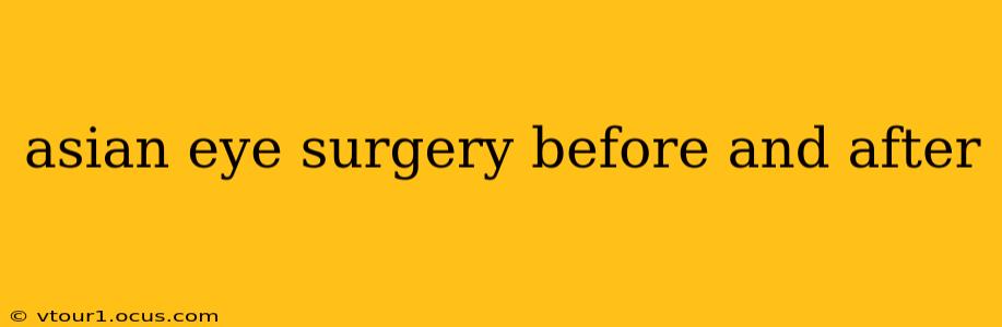 asian eye surgery before and after