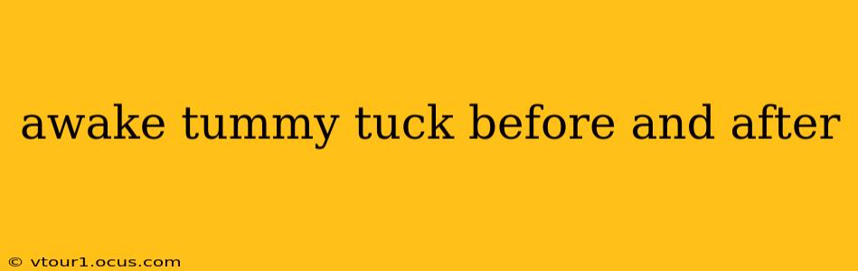 awake tummy tuck before and after