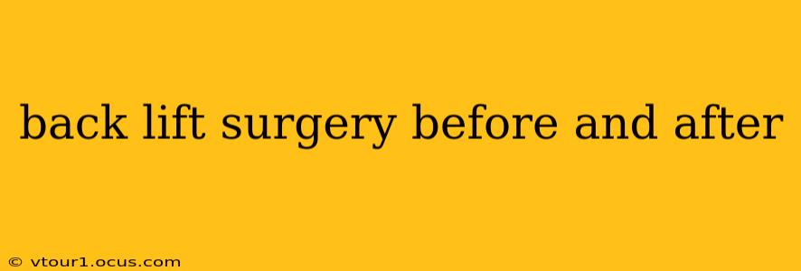 back lift surgery before and after