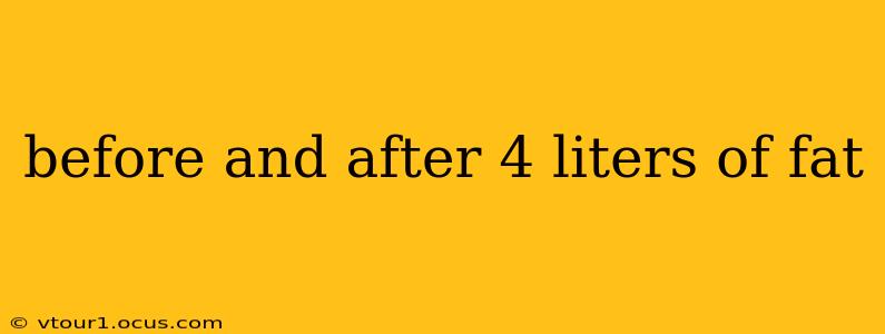 before and after 4 liters of fat