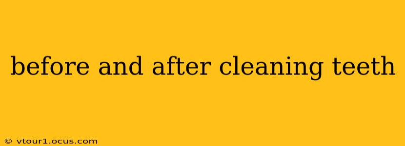 before and after cleaning teeth