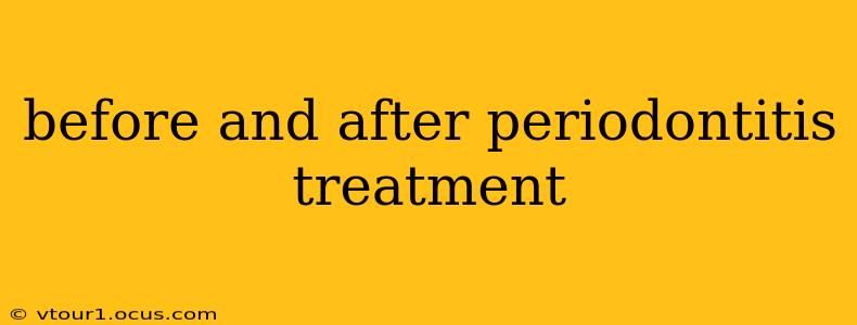 before and after periodontitis treatment
