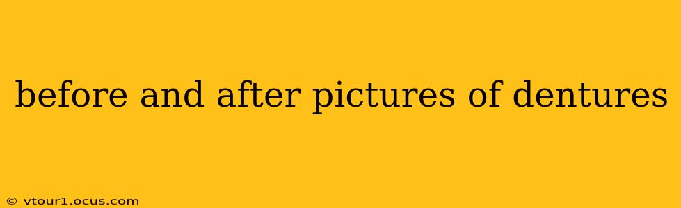before and after pictures of dentures