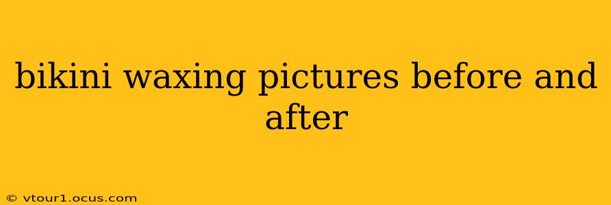 bikini waxing pictures before and after