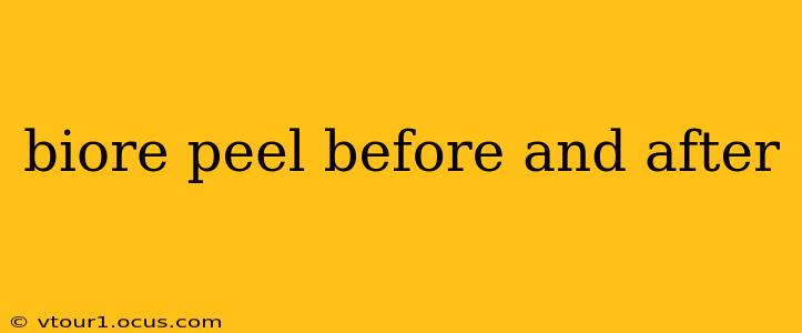 biore peel before and after