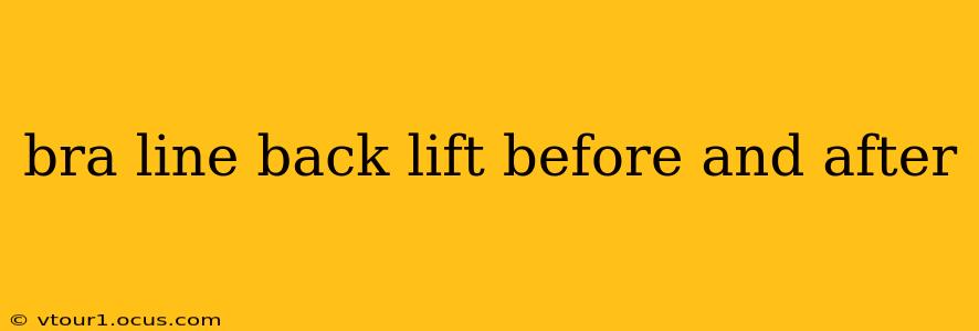 bra line back lift before and after