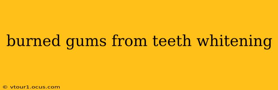 burned gums from teeth whitening