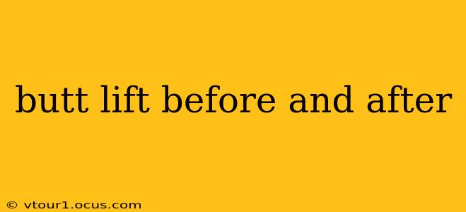 butt lift before and after