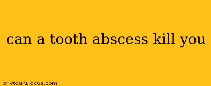 can a tooth abscess kill you