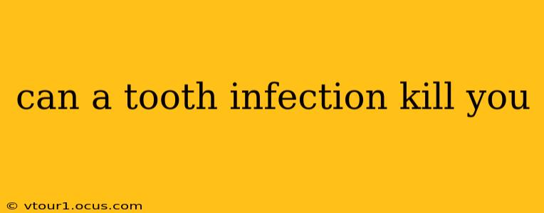 can a tooth infection kill you