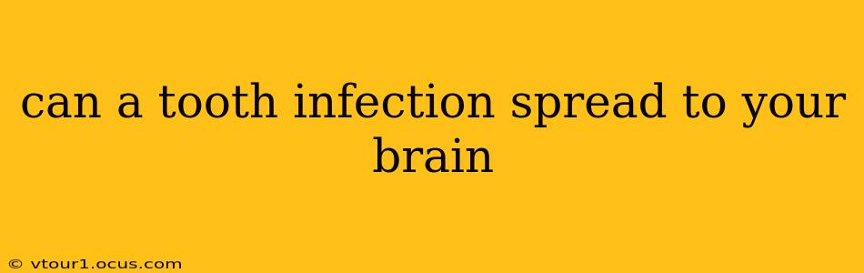 can a tooth infection spread to your brain