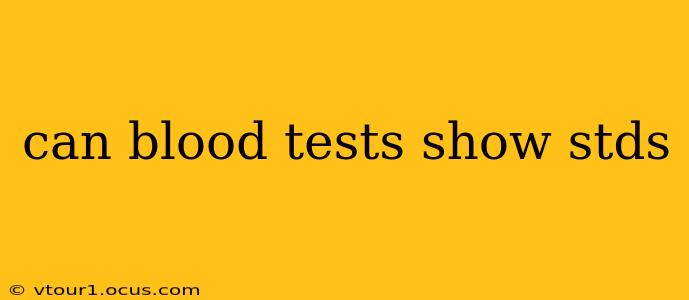 can blood tests show stds