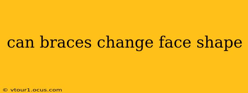 can braces change face shape
