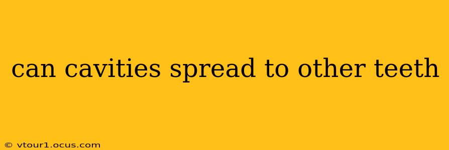 can cavities spread to other teeth