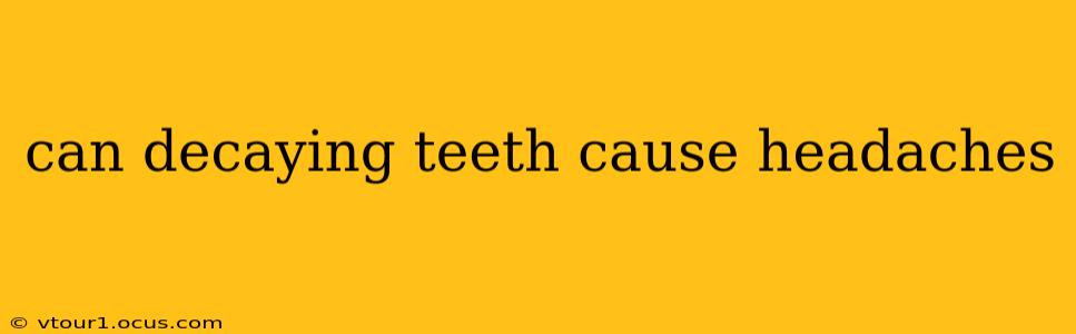 can decaying teeth cause headaches