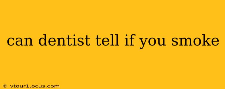 can dentist tell if you smoke