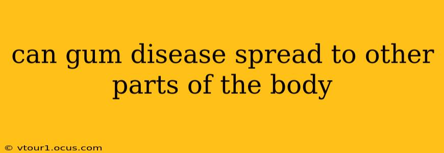 can gum disease spread to other parts of the body