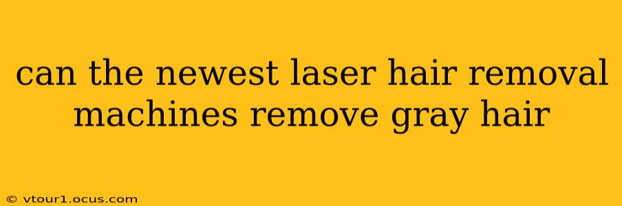 can the newest laser hair removal machines remove gray hair