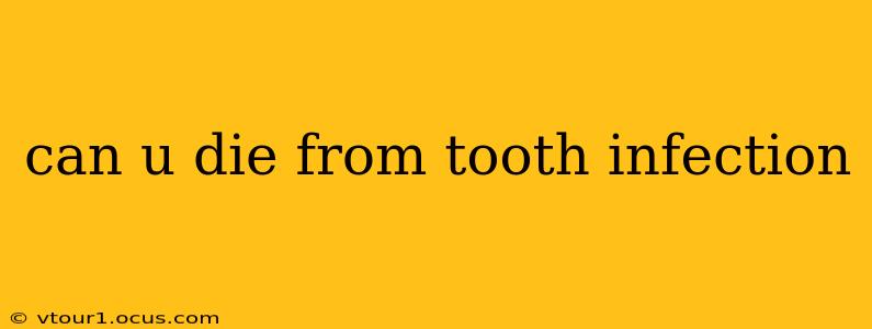 can u die from tooth infection
