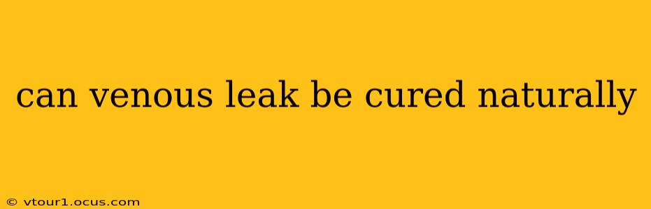 can venous leak be cured naturally