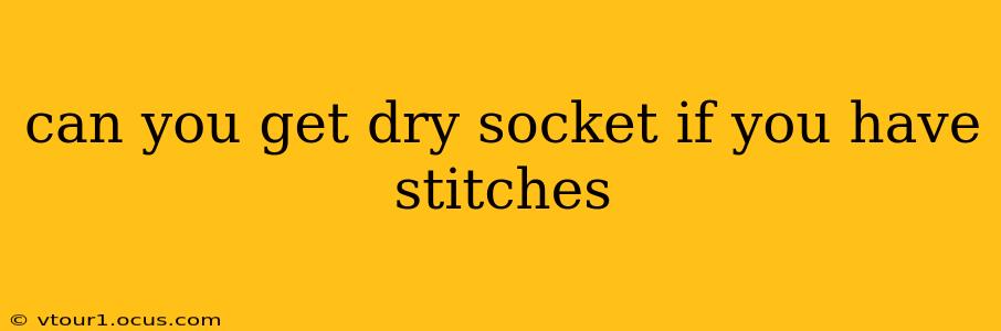 can you get dry socket if you have stitches