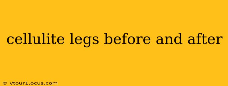 cellulite legs before and after