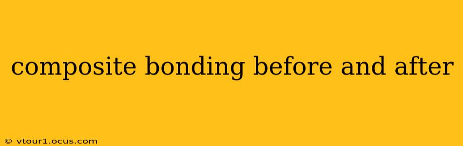 composite bonding before and after