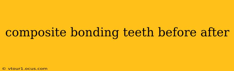 composite bonding teeth before after