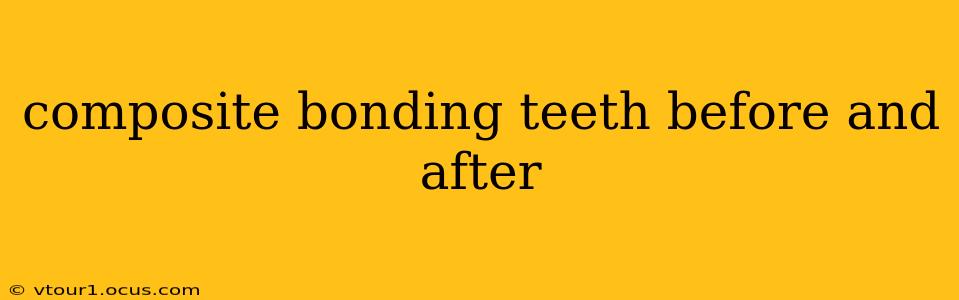 composite bonding teeth before and after