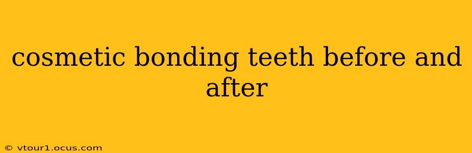 cosmetic bonding teeth before and after