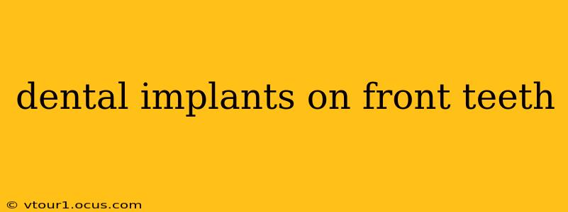 dental implants on front teeth