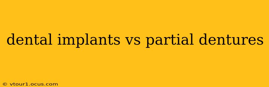 dental implants vs partial dentures