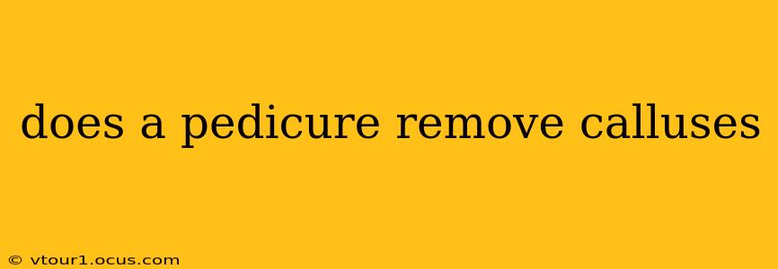does a pedicure remove calluses