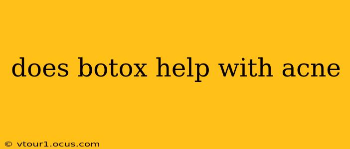 does botox help with acne