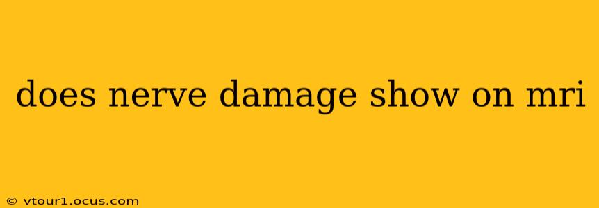 does nerve damage show on mri