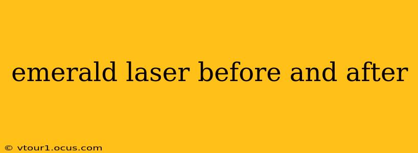 emerald laser before and after