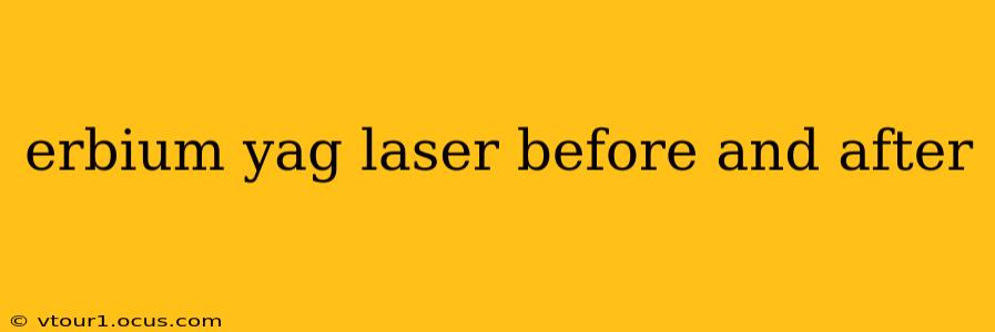 erbium yag laser before and after