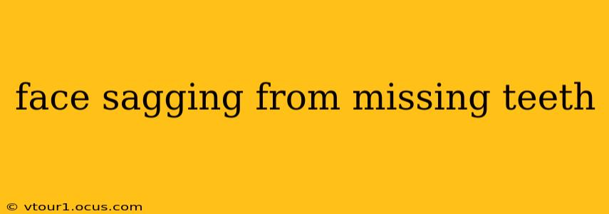 face sagging from missing teeth
