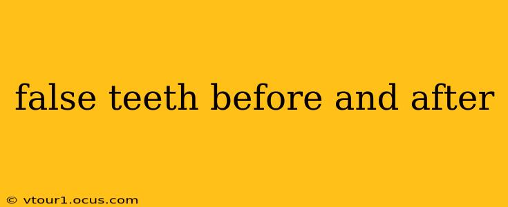 false teeth before and after