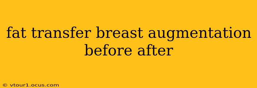 fat transfer breast augmentation before after