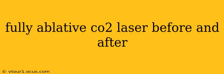 fully ablative co2 laser before and after