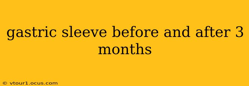 gastric sleeve before and after 3 months