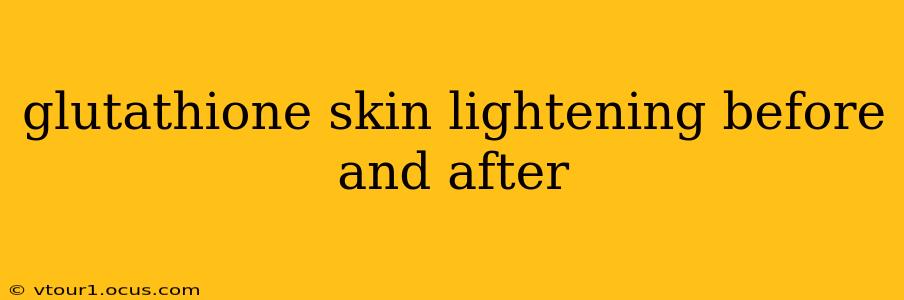 glutathione skin lightening before and after